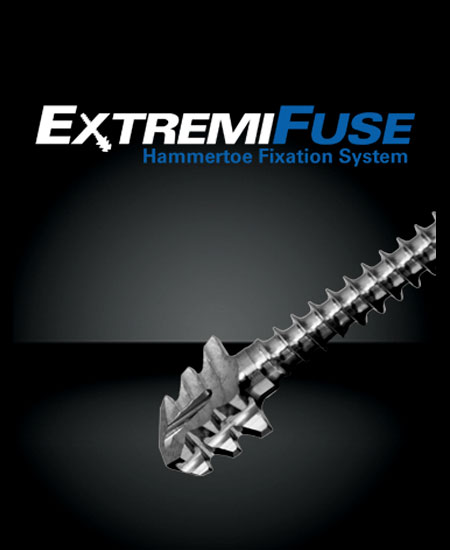 Fijación de Dedo ExtremiFuse