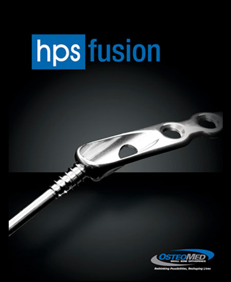 Sistema de Fusión Osteomed