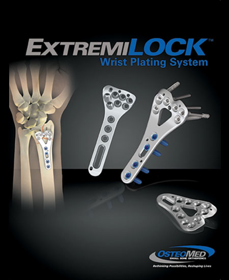 Osteomed ExtremiLock Wrist