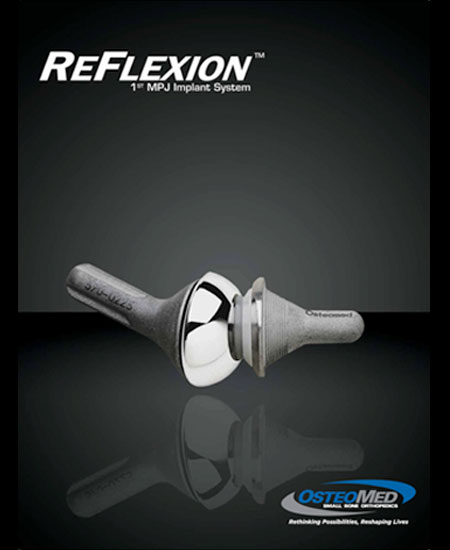 Sistema de Reflexión de Dedo