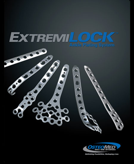 Osteomed ExtremiLock